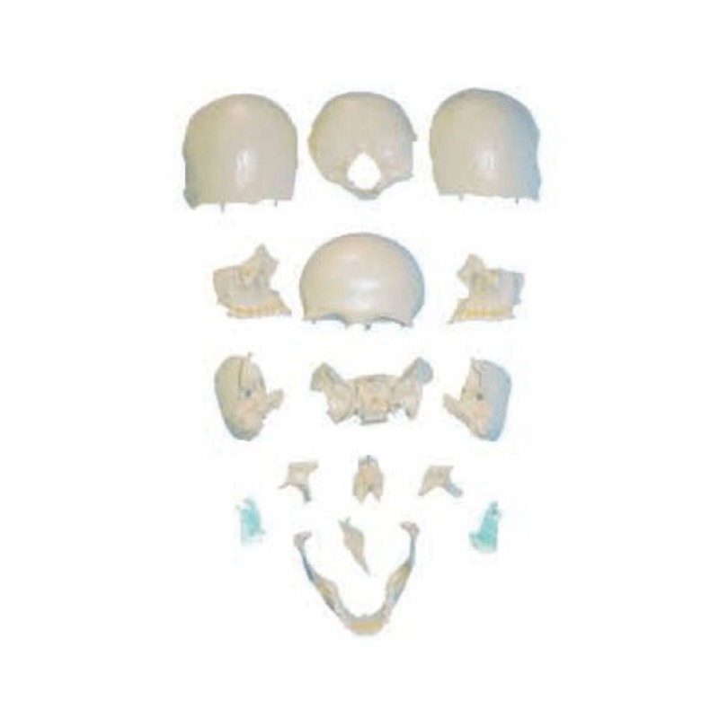 分离头颅骨散骨模型实训考核装置  分离头颅骨散骨模型实训设备  分离头颅骨散骨模型综合实训台