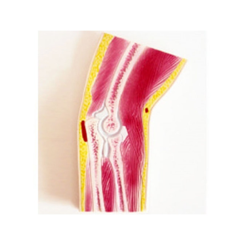 肘关节剖面模型实训考核装置  肘关节剖面模型实训设备  肘关节剖面模型综合实训台图片