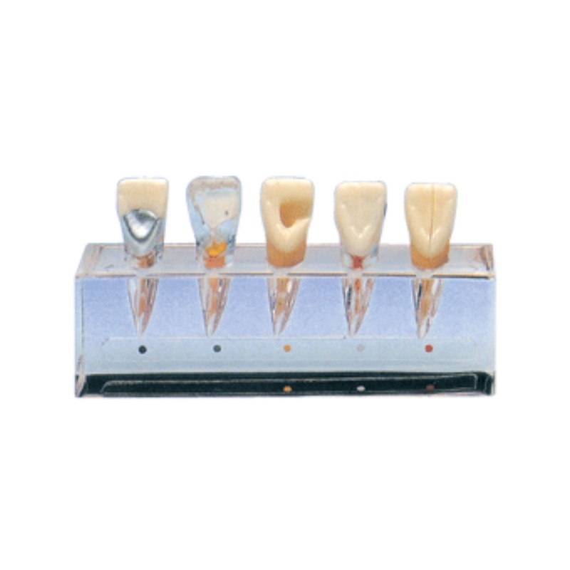 牙髓病临床模型实训考核装置      牙髓病临床模型实训设备      牙髓病临床模型综合实训台